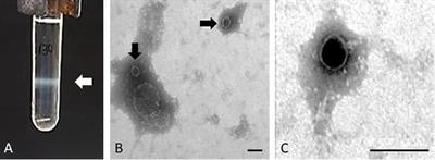 Investigation on the Evolution of Shiga Toxin-Converting Phages Based on Whole Genome Sequencing